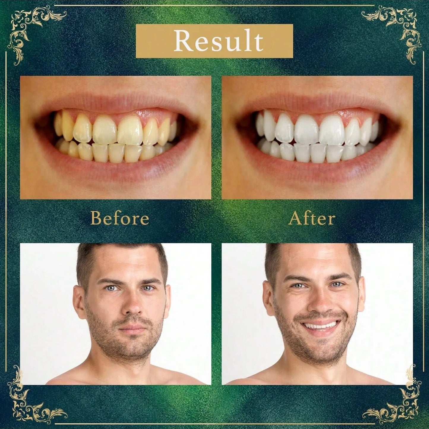 Natural Branch Miswak Toothbrush Stick