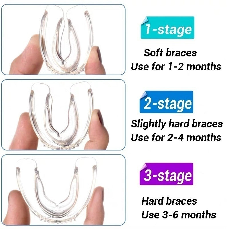 3 Stage Dental Orthodontic Braces