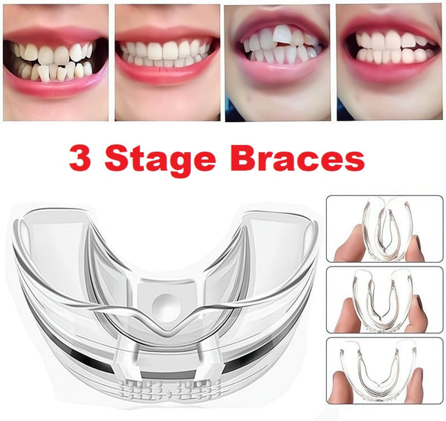 3 Stage Dental Orthodontic Braces